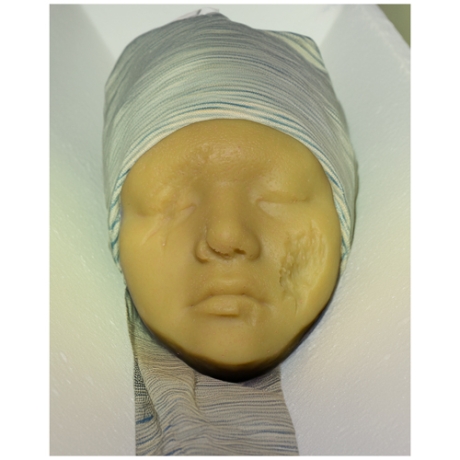 欠損・変色の顔（小サイズ）